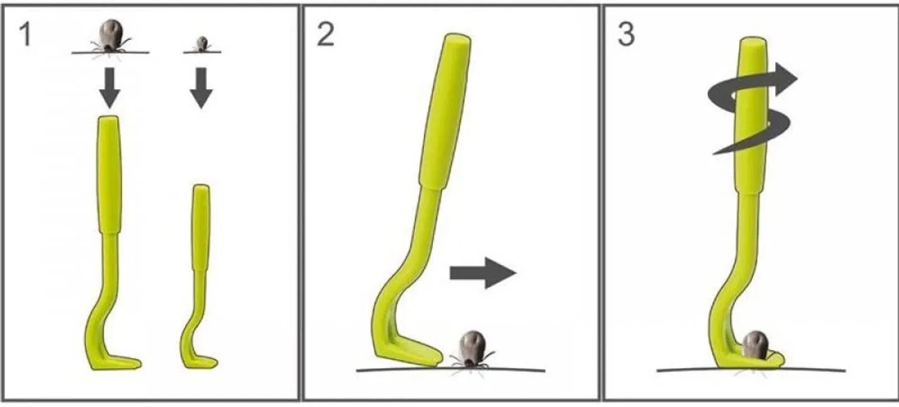 Tick Twister | UST